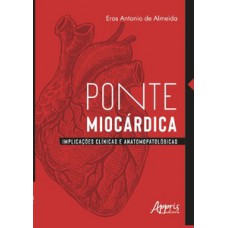 Ponte miocárdica Ponte miocárdica