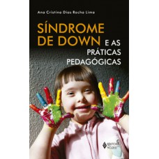 Síndrome de down e as práticas pedagógicas Síndrome de down e as práticas pedagógicas